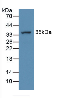 Polyclonal Antibody to ATPase, H+ Transporting, Lysosomal Accessory Protein 2 (ATP6AP2)