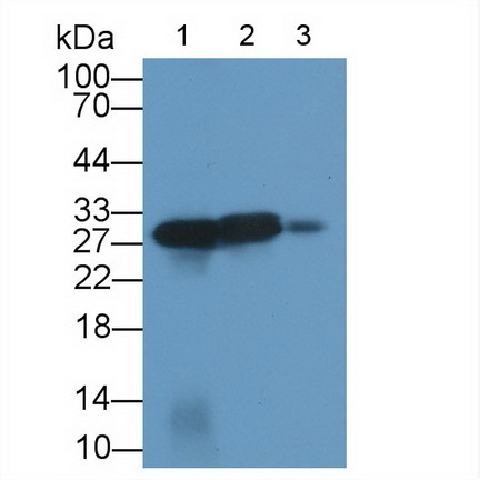 Polyclonal Antibody to Calbindin (CALB)