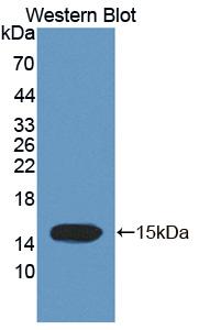 Polyclonal Antibody to Trichohyalin (TCHH)