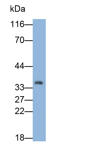 Polyclonal Antibody to Microtubule Associated Protein RP/EB Family, Member 1 (MAPRE1)