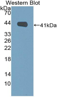 Polyclonal Antibody to Secretoglobin Family 3A, Member 1 (SCGB3A1)