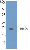 Polyclonal Antibody to Lysophosphatidylcholine Acyltransferase 3 (LPCAT3)