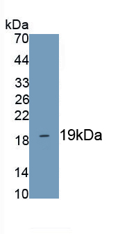 Polyclonal Antibody to Lysophosphatidylcholine Acyltransferase 3 (LPCAT3)