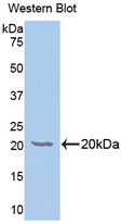 Polyclonal Antibody to Galactosylceramidase (GALC)