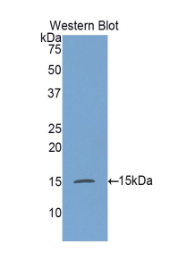 Polyclonal Antibody to Galactosylceramidase (GALC)