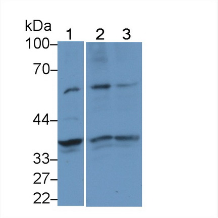 Polyclonal Antibody to Thyroid Transcription Factor 1 (TITF1)