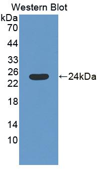 Polyclonal Antibody to Spermidine/Spermine N1-Acetyltransferase 1 (SAT1)