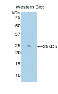 Polyclonal Antibody to Lysine Specific Demethylase 4C (KDM4C)