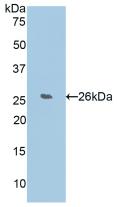 Polyclonal Antibody to WNT1 Inducible Signaling Pathway Protein 2 (WISP2)