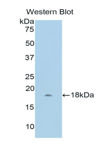 Polyclonal Antibody to WNT1 Inducible Signaling Pathway Protein 1 (WISP1)