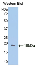 Polyclonal Antibody to WNT1 Inducible Signaling Pathway Protein 1 (WISP1)