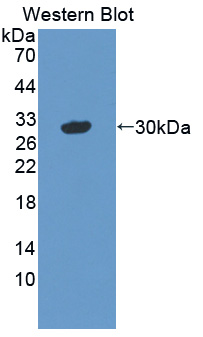 Polyclonal Antibody to Vasorin (VASN)