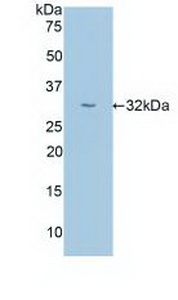 Polyclonal Antibody to Uromodulin (UMOD)