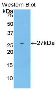 Polyclonal Antibody to Ubiquitin Carboxyl Terminal Hydrolase L5 (UCHL5)