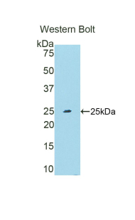 Polyclonal Antibody to Ubiquitin Carboxyl Terminal Hydrolase L5 (UCHL5)