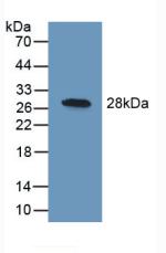 Polyclonal Antibody to Ubiquitin Carboxyl Terminal Hydrolase L1 (UCHL1)