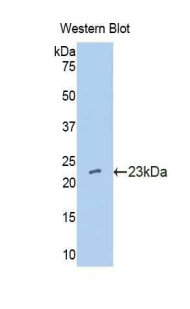 Polyclonal Antibody to Interferon Alpha 10 (IFNa10)