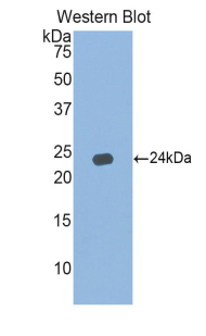 Polyclonal Antibody to Interferon Alpha 5 (IFNa5)