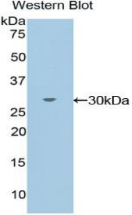 Polyclonal Antibody to TXK Tyrosine Kinase (TXK)