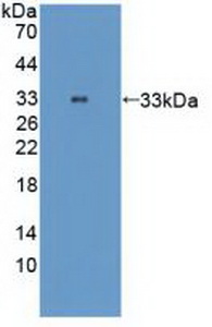 Polyclonal Antibody to TTK Protein Kinase (TTK)