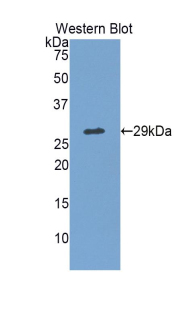 Polyclonal Antibody to TTK Protein Kinase (TTK)