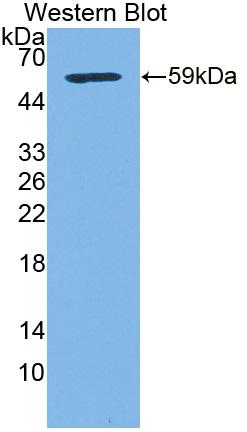 Polyclonal Antibody to Transketolase Like Protein 1 (TKTL1)