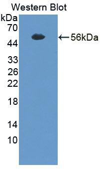 Polyclonal Antibody to Trans Golgi Network Protein 2 (TGOLN2)