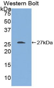 Polyclonal Antibody to Transforming Growth Factor Beta 1 Induced Transcript 1 (<b>TGFb1</b>I1)