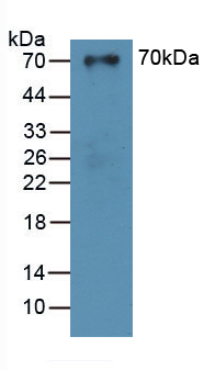 Polyclonal Antibody to Sulfite Oxidase (SUOX)