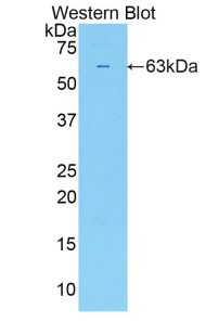 Polyclonal Antibody to Sulfatase 2 (SULF2)