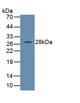 Polyclonal Antibody to Suppressors Of Cytokine Signaling 1 (SOCS1)