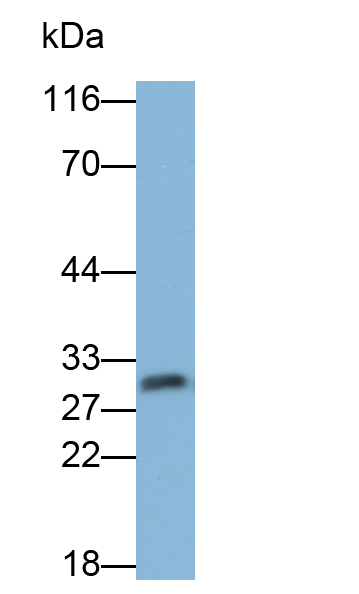 Polyclonal Antibody to Stratifin (SFN)