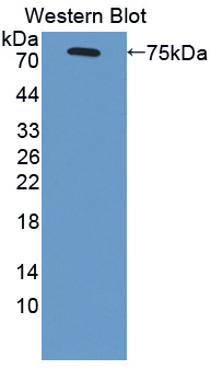 Polyclonal Antibody to Scavenger Receptor Class B Member 1 (SCARB1)