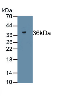 Polyclonal Antibody to Reticulocalbin 2 (RCN2)