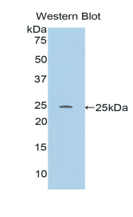 Polyclonal Antibody to RalA Binding Protein 1 (RALBP1)
