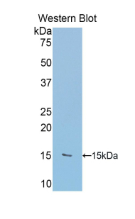 Polyclonal Antibody to RalA Binding Protein 1 (RALBP1)