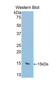 Polyclonal Antibody to RalA Binding Protein 1 (RALBP1)