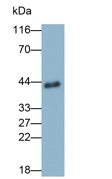 PAH274Hu01.jpg