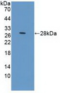 Polyclonal Antibody to Prolactin Receptor (PRLR)