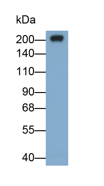 Polyclonal Antibody to Periplakin (PPL)