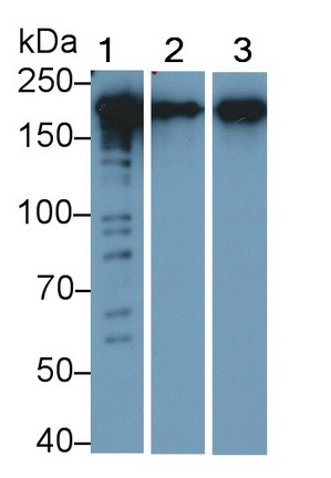 Polyclonal Antibody to Periplakin (PPL)