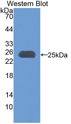 Polyclonal Antibody to Peroxisome Proliferator Activated Receptor Gamma Coactivator 1 Alpha (PPARgC1a)