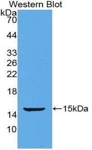 Polyclonal Antibody to Periostin (POSTN)