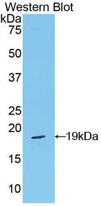 Polyclonal Antibody to Periostin (POSTN)