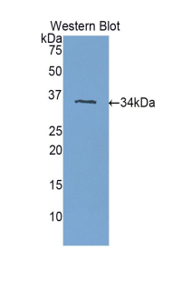 Polyclonal Antibody to Plexin B1 (PLXNB1)