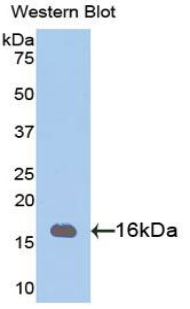 Polyclonal Antibody to Phosphohistidine Phosphatase 1 (PHPT1)