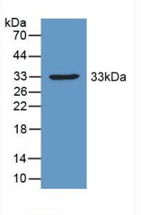 Polyclonal Antibody to Pyruvate Dehydrogenase Complex Component X (PDHX)