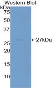 Polyclonal Antibody to Nicotinamide-N-Methyltransferase (NNMT)