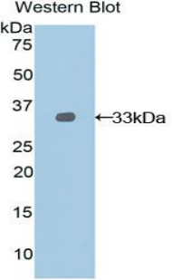 Polyclonal Antibody to Nexilin (NEXN)