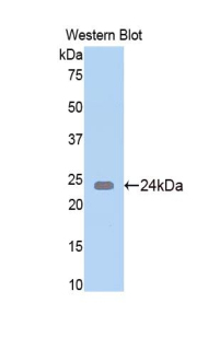 Polyclonal Antibody to N-Acetylgalactosaminidase Alpha (NAGa)